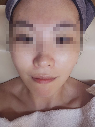목동 피부관리 내돈내산 에스테틱 추천 | 오목교역 근처 피부관리 맛집 라임스킨 재방문 후기 이미지 6