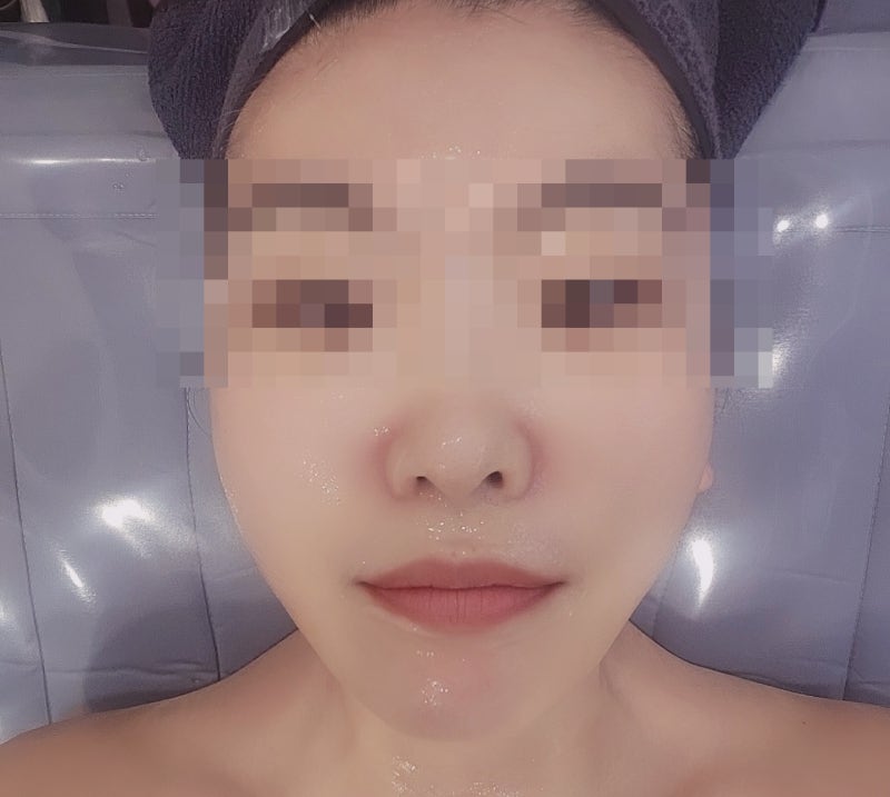 신논현 논현동 피부관리 추천 | 얼굴 윤곽관리 바디 슬리밍 관리 맛집 신논현역 로터스에스테 후기 이미지 12