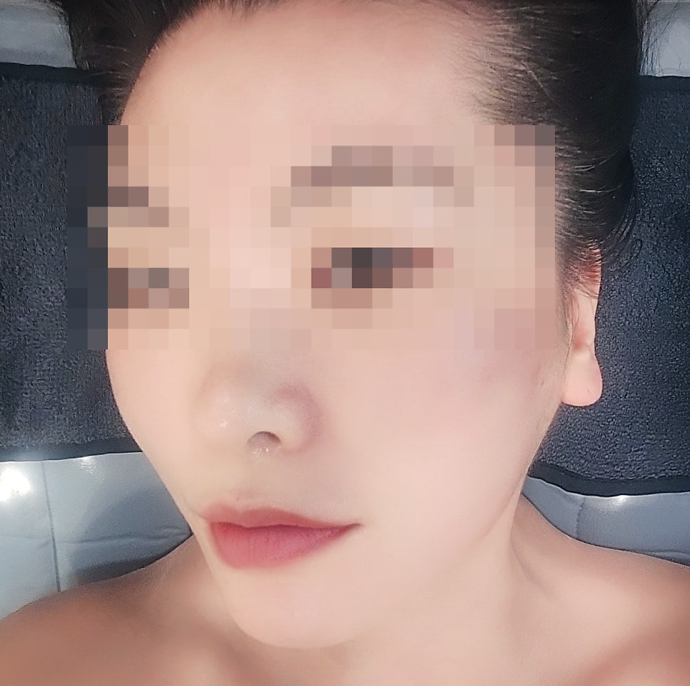 신논현 논현동 피부관리 추천 | 얼굴 윤곽관리 바디 슬리밍 관리 맛집 신논현역 로터스에스테 후기 이미지 16