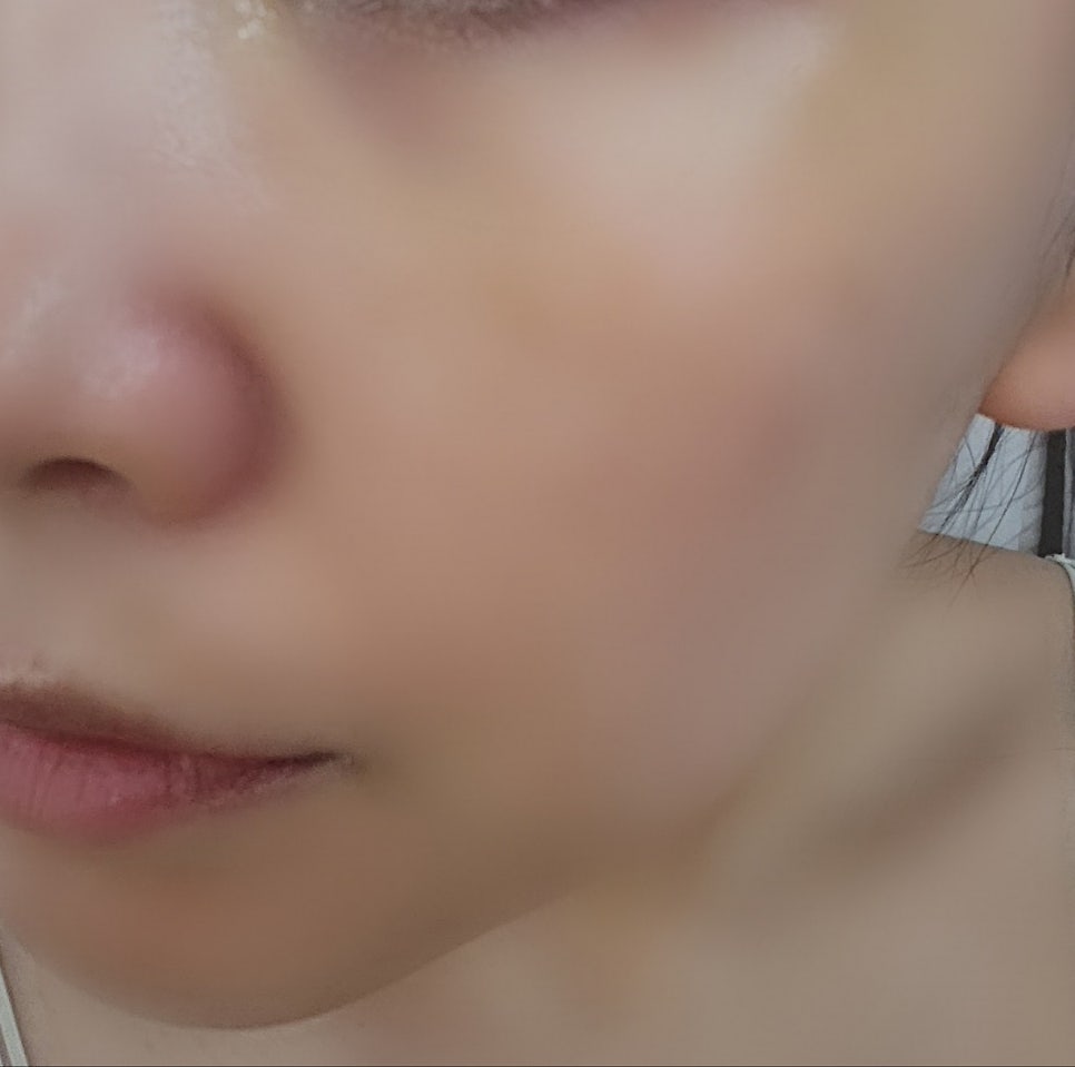 내돈내산 뷰티디바이스 홈모드 사용기 | 홈모드 8주차 후기 및 부스터 엑소샷 후기 이미지 7