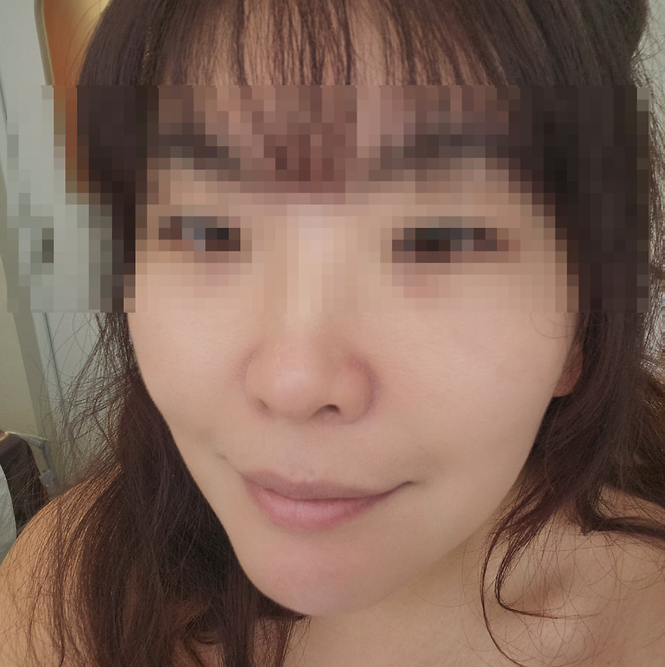 선릉 에스테틱 역삼 피부관리 추천 | 무료 주차 가능한 아임에스테틱강남역삼점에서 역삼 윤곽관리 받은 후기 이미지 17