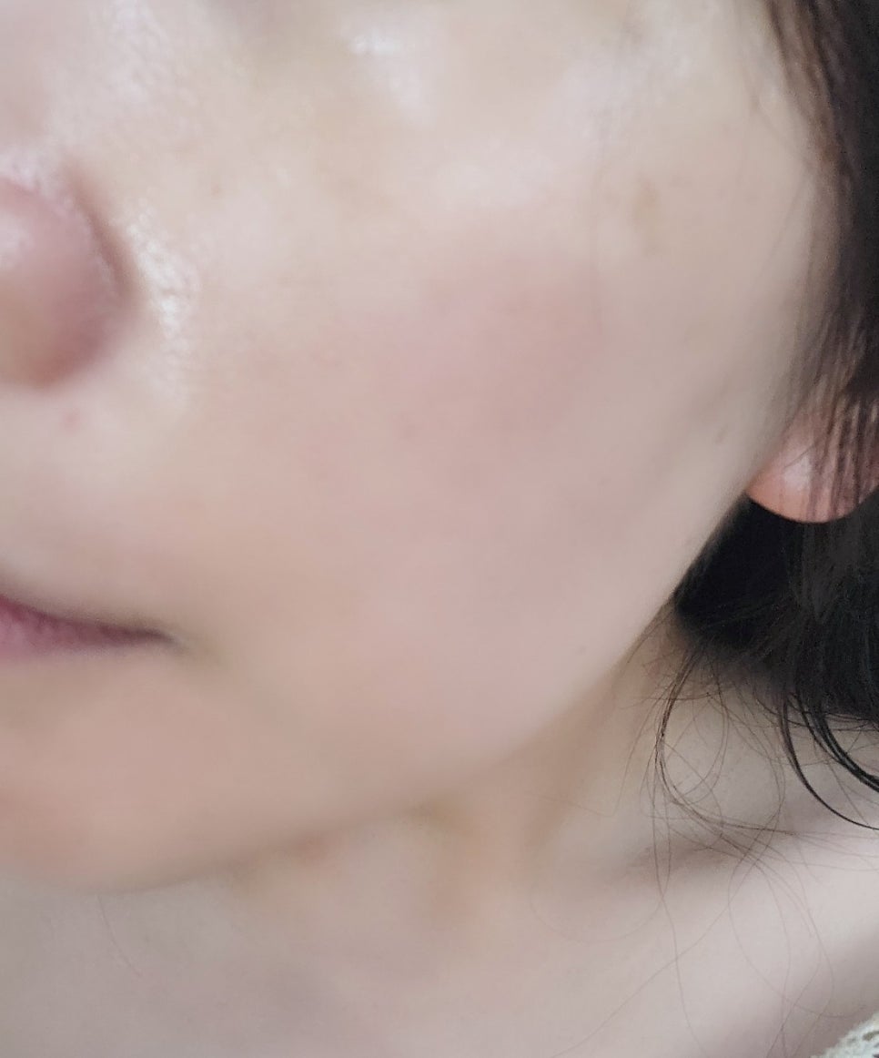 내돈내산 뷰티디바이스 홈모드 사용기 | 홈모드 써마 리프트 한달 사용 후기 이미지 10