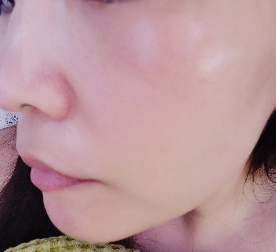 내돈내산 뷰티디바이스 홈모드 사용기 | 홈모드 FirmaRF Face-Up Eye-Up 모드 사용 2주차 후기 이미지 9