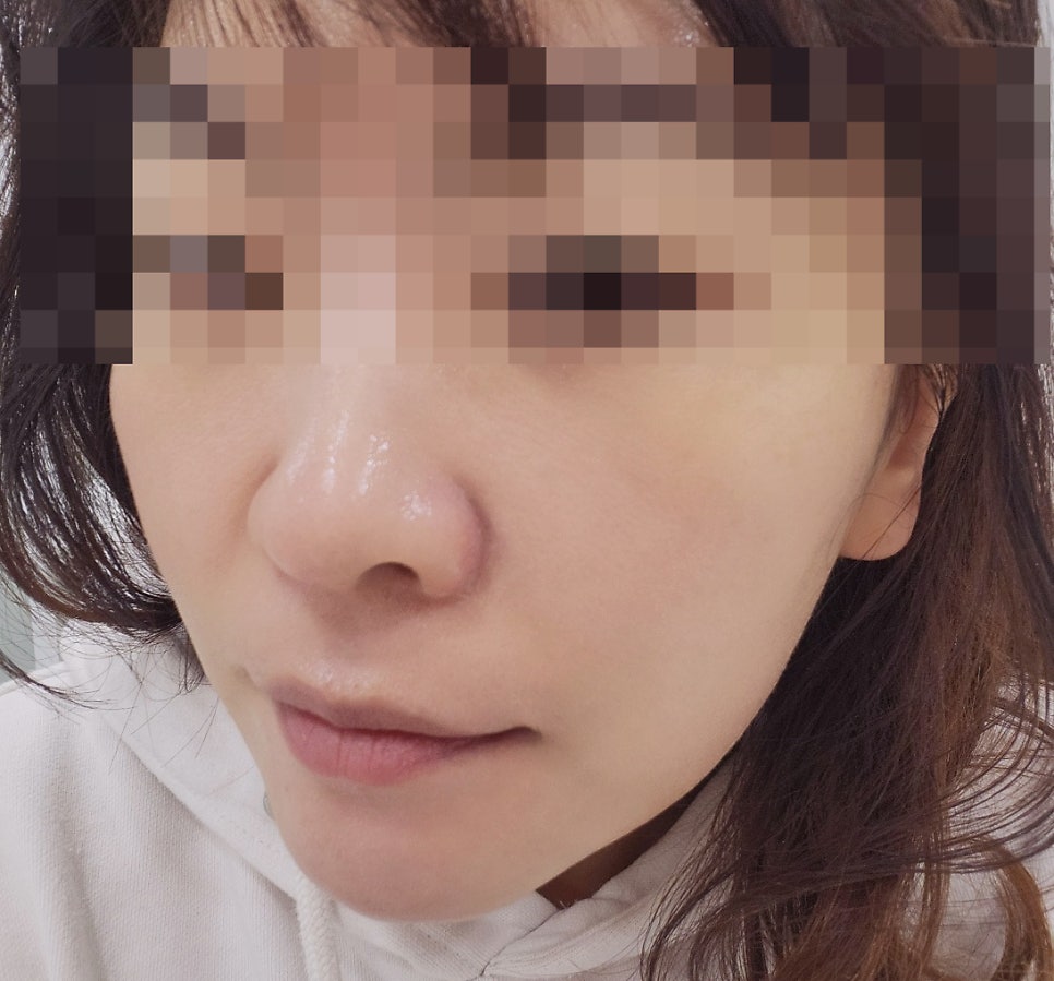 강남역피부관리 추천 | 모공케어 강남웨딩케어 전문 강남에스테틱 아나토미에스테틱 후기 이미지 25