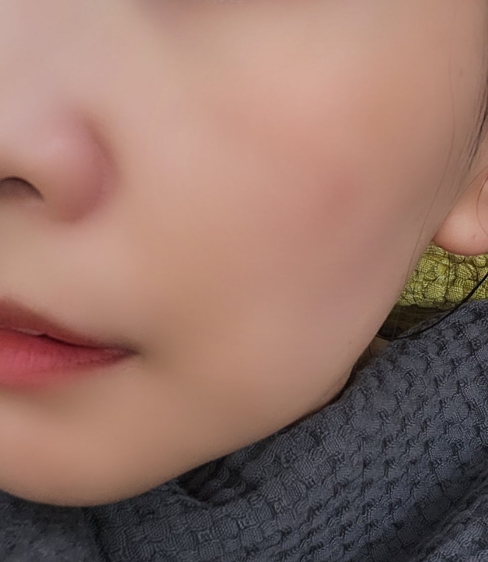 내돈내산 뷰티디바이스 홈모드 사용기 | 볼패임 걱정인 사람의 홈모드 7주차 후기 이미지 5