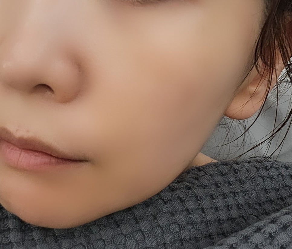 내돈내산 뷰티디바이스 홈모드 사용기 | 홈모드 8주차 후기 및 부스터 엑소샷 후기 이미지 6