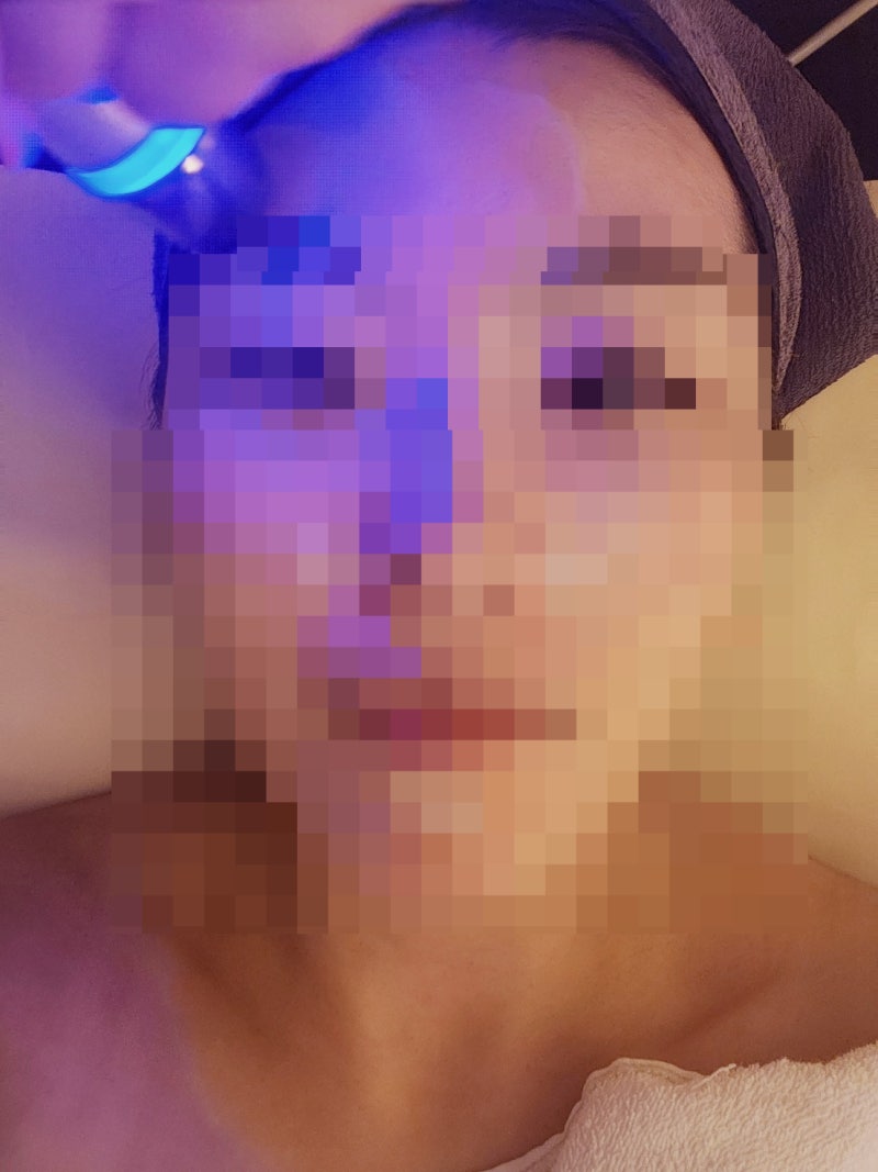 목동 피부관리 내돈내산 에스테틱 추천 | 오목교역 근처 피부관리 맛집 라임스킨 재방문 후기
