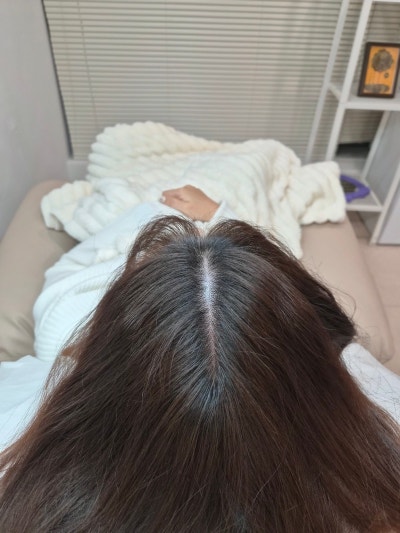 영등포 탈모 두피관리 추천 | 서울 미인점도 가능한 모다스튜디오 정수리 채움 시술 후기 이미지 16