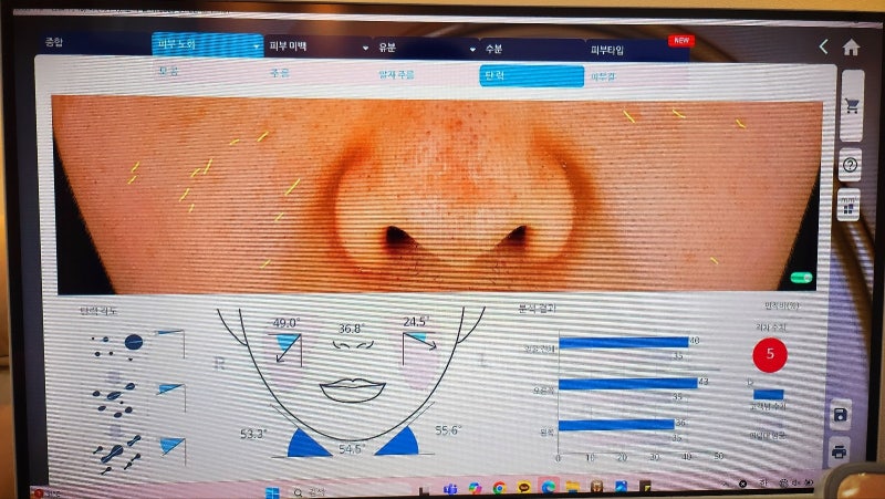 목동 피부관리 에스테틱 추천 | 오목교역 근처 피부관리 맛집 라임스킨 후기 이미지 12