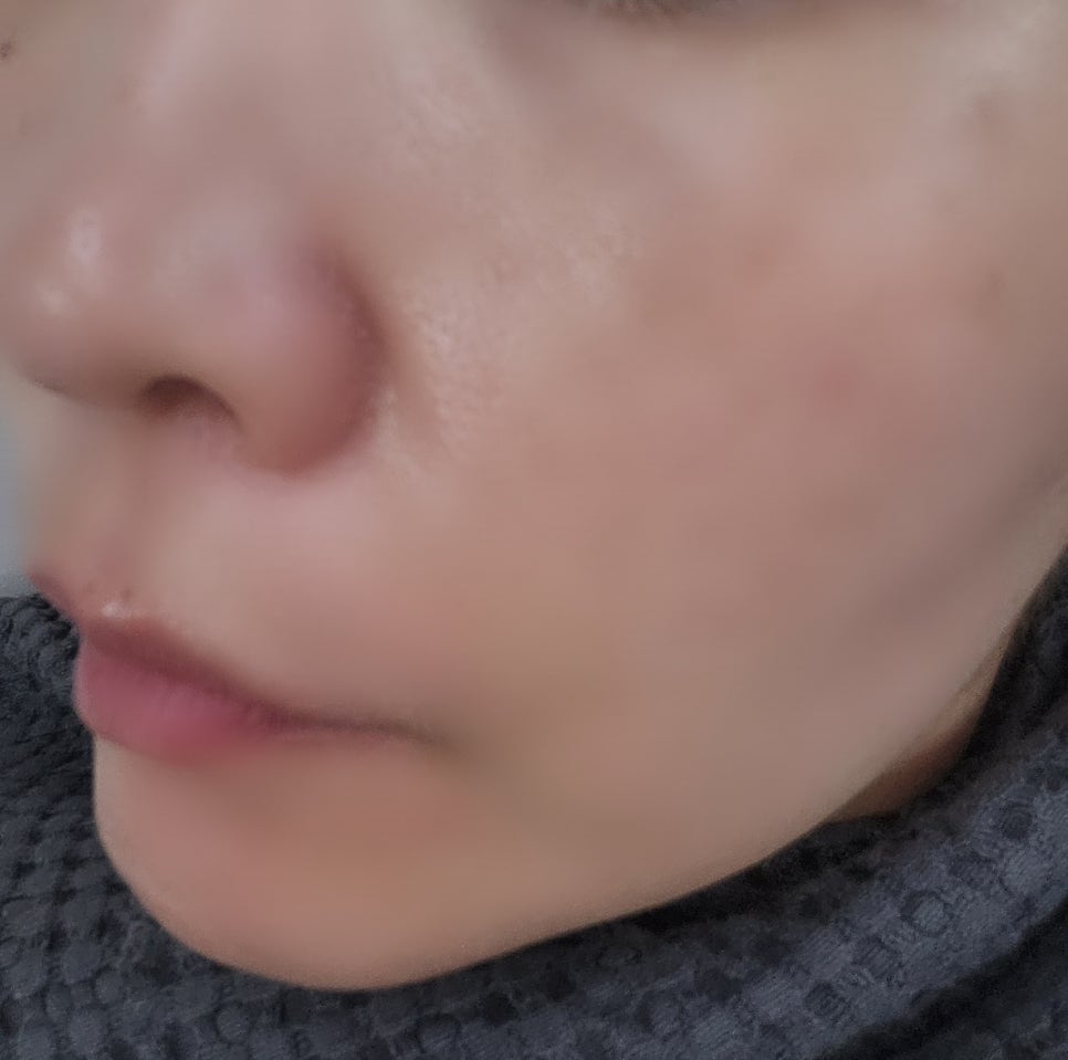 내돈내산 뷰티디바이스 홈모드 사용기 | 홈모드 FirmaRF Face-Up Eye-Up 모드 사용 2주차 후기 이미지 10