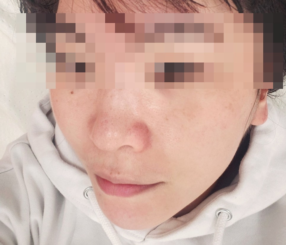 강남역피부관리 추천 | 모공케어 강남웨딩케어 전문 강남에스테틱 아나토미에스테틱 후기 이미지 24