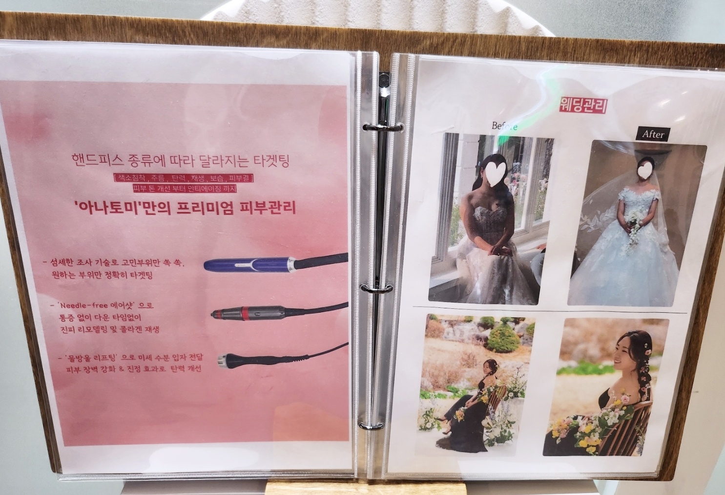 강남역피부관리 추천 | 모공케어 강남웨딩케어 전문 강남에스테틱 아나토미에스테틱 후기 이미지 16