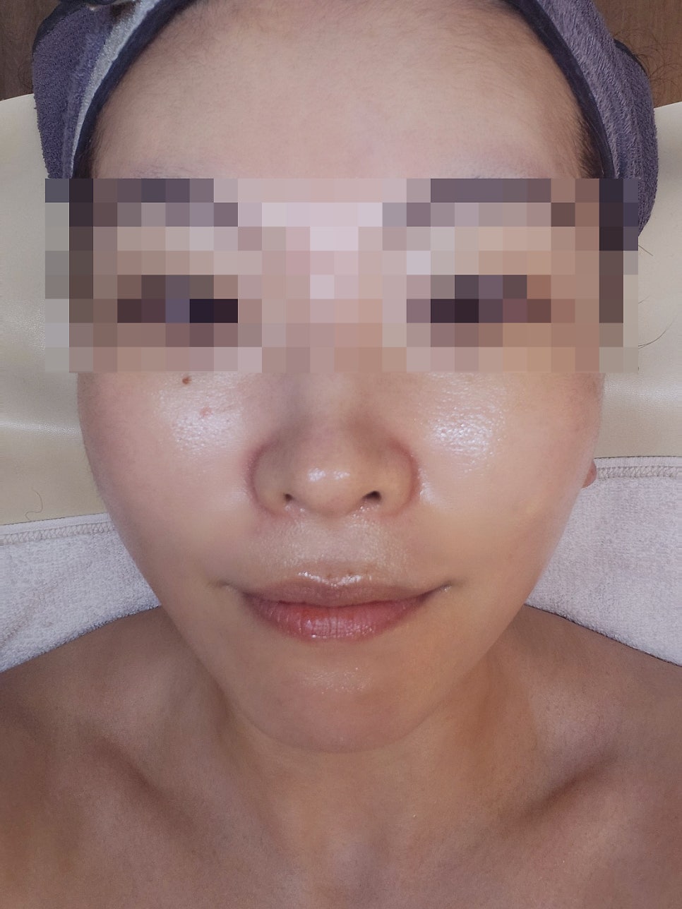 목동 피부관리 내돈내산 에스테틱 추천 | 오목교역 근처 피부관리 맛집 라임스킨 재방문 후기 이미지 7