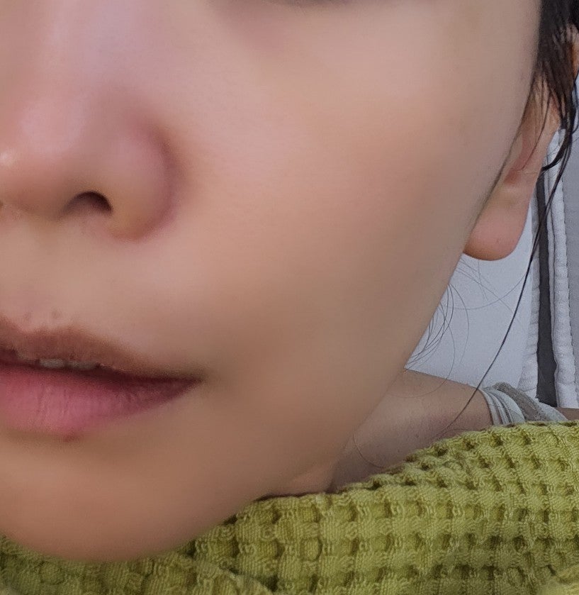 내돈내산 뷰티디바이스 홈모드 사용기 | 홈모드 9주차 후기 및 부스터 리쥬샷 후기 이미지 5