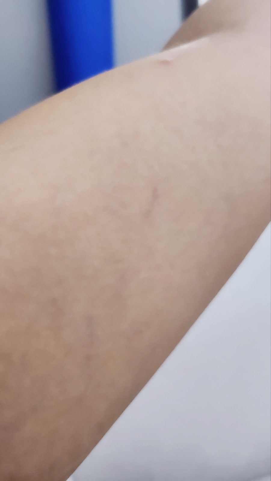 내돈내산 뷰티디바이스 홈모드 사용기 | 홈모드 SlimVX Body 모드 사용 3주차 후기 이미지 10