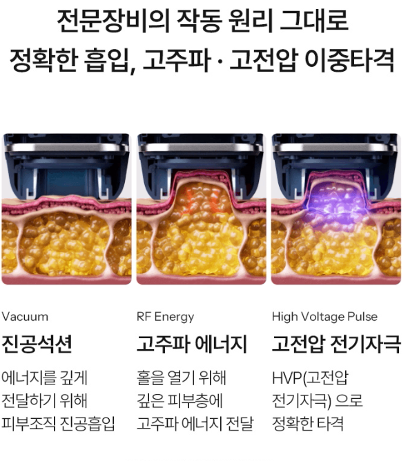 내돈내산 뷰티디바이스 홈모드 사용기 | 홈모드 SlimVX Body 모드 사용 3주차 후기 이미지 3