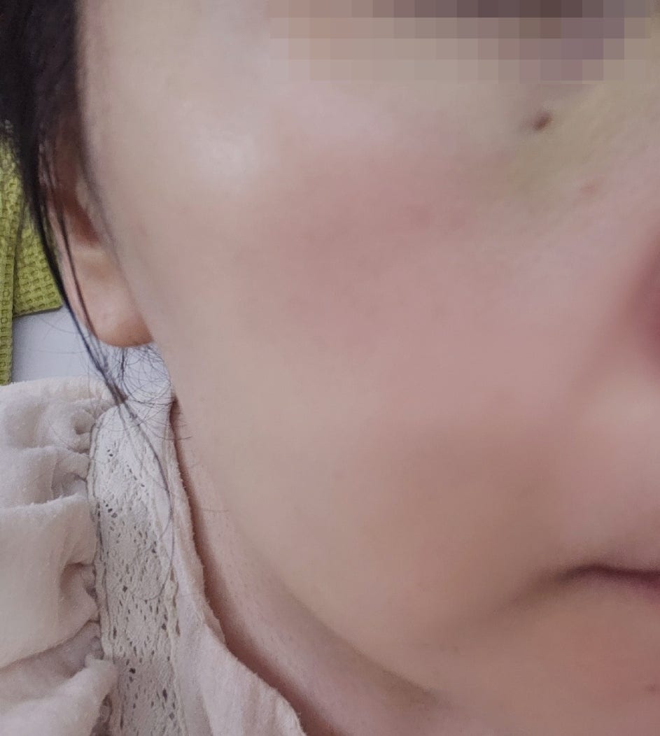 히알루론산세럼 추천 | 환절기스킨케어 시카 병풀 버블팩 수면팩 캄프 퀵 글로우 버블세럼 후기 이미지 8
