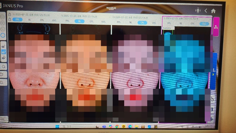 목동 피부관리 에스테틱 추천 | 오목교역 근처 피부관리 맛집 라임스킨 후기 이미지 10