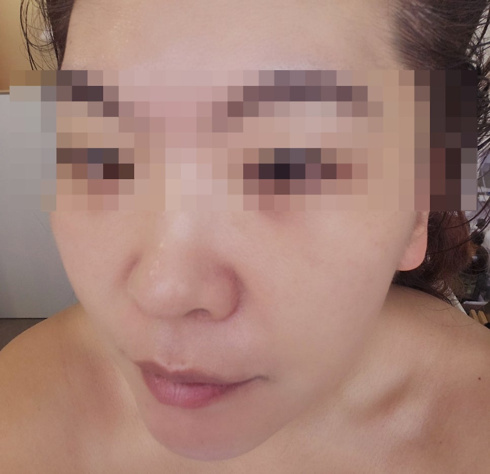 선릉 에스테틱 역삼 피부관리 추천 | 무료 주차 가능한 아임에스테틱강남역삼점에서 역삼 윤곽관리 받은 후기 이미지 18