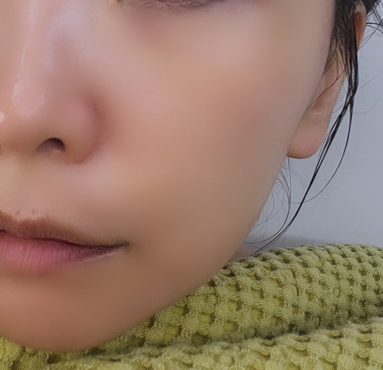 내돈내산 뷰티디바이스 홈모드 사용기 | 홈모드 9주차 후기 및 부스터 리쥬샷 후기 이미지 6