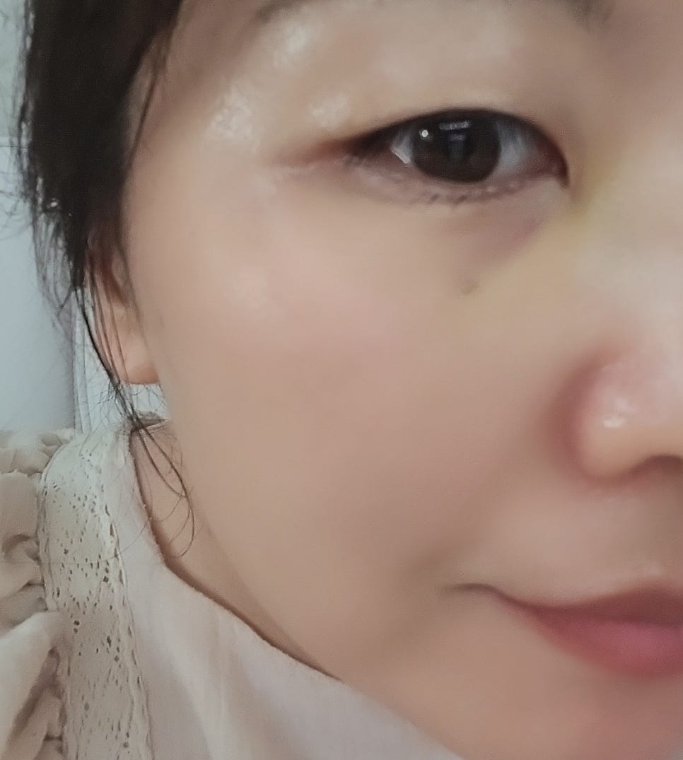 히알루론산세럼 추천 | 환절기스킨케어 시카 병풀 버블팩 수면팩 캄프 퀵 글로우 버블세럼 후기 이미지 9